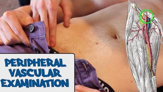 Peripheral Vascular Examination – OSCE Guide (New Version)