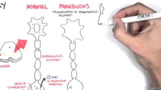 Pharmacology – Parkinson’s Disease