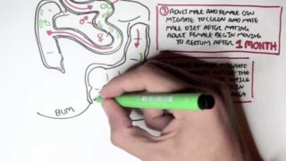 Pin Worms – Enterobius Vermicularis