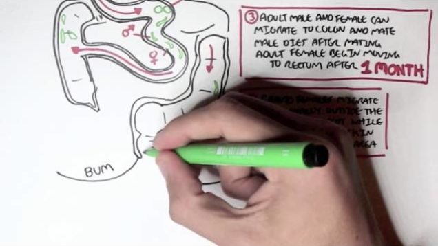 Pin Worms – Enterobius Vermicularis