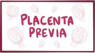 Placenta previa – causes, symptoms, diagnosis, treatment, pathology