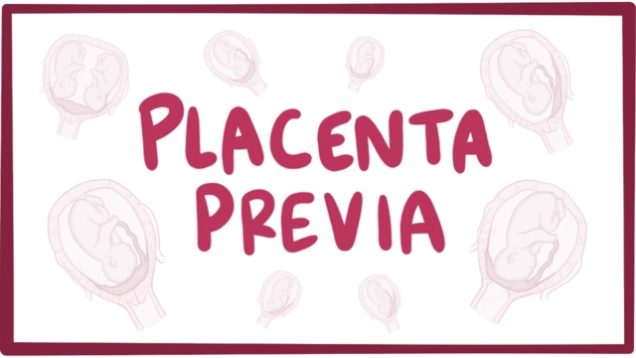 Placenta previa – causes, symptoms, diagnosis, treatment, pathology