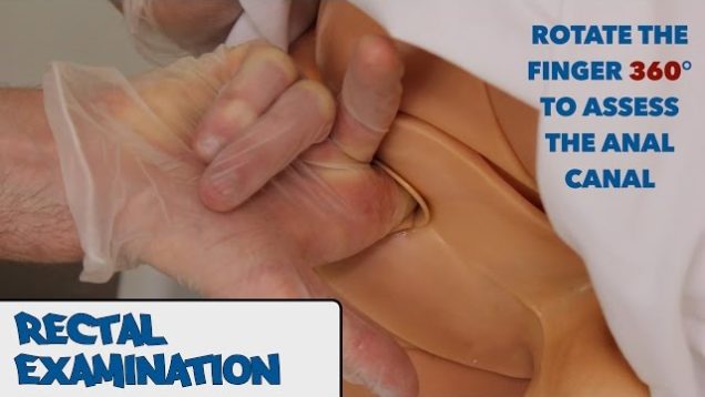 Rectal Examination (PR) – OSCE Guide