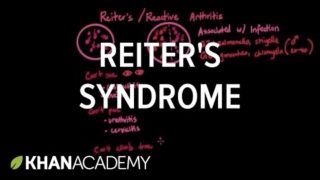 Reiter’s syndrome | Muscular-skeletal diseases | NCLEX-RN | Khan Academy