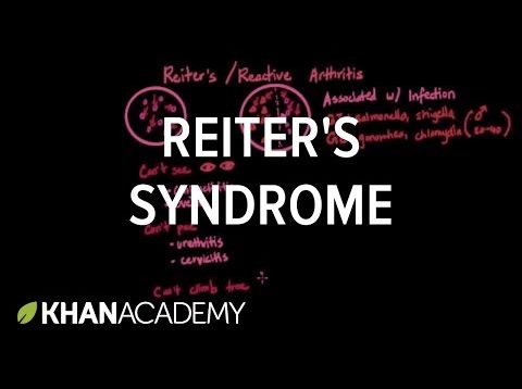 Reiter’s syndrome | Muscular-skeletal diseases | NCLEX-RN | Khan Academy