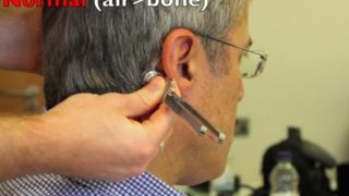 Rinne & Weber test - Physical Exam Rinnes and Webers test