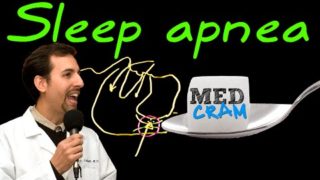 Obstructive Sleep Apnea (OSA)