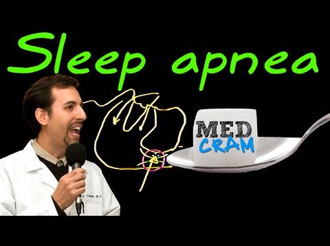 Obstructive Sleep Apnea (OSA)