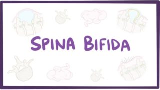 Spina bifida (myelomeningocele, meningocele, occulta) – causes, symptoms, treatment