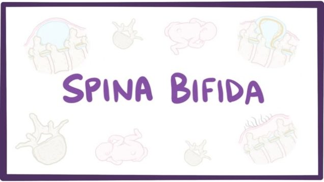Spina bifida (myelomeningocele, meningocele, occulta) – causes, symptoms, treatment