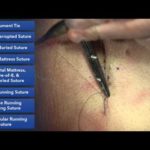 Suture Skills Course - Learn Best Suture Techniques