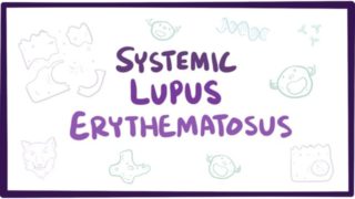 Systemic lupus erythematosus (SLE) – causes, symptoms, diagnosis & pathology