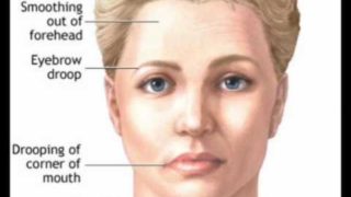 The Cranial Nerves Song