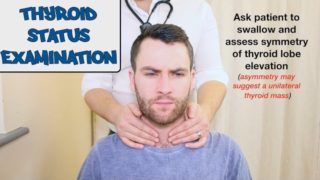 Thyroid Gland - Physical Exam Thyroid Status Examination – OSCE Guide