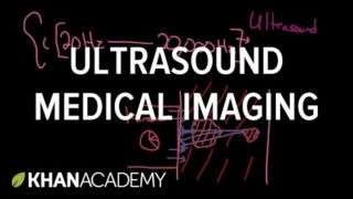 Ultrasound medical imaging | Mechanical waves and sound | Physics | Khan Academy
