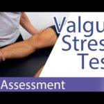 Valgus Stress Test (Knee) - Physical Exam