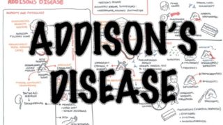 Addison’s Disease – (DETAILED) Overview