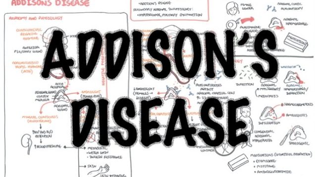 Addison’s Disease – (DETAILED) Overview