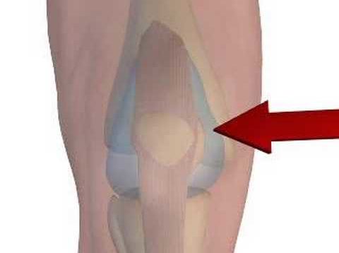 arthrocentesis of the knee