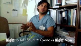 Congenital Heart Disease Shunt Mnemonic