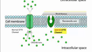 Cystic Fibrosis Mnemonic