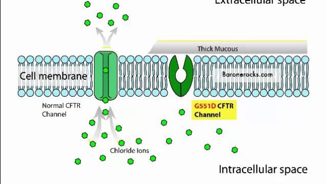 Cystic Fibrosis Mnemonic