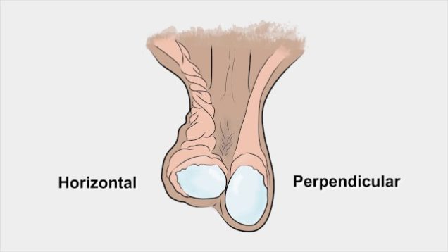 Examination of the Scrotum