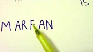 Marfan Syndrome Mnemonic