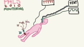 PALS 03: Monitoring And Access