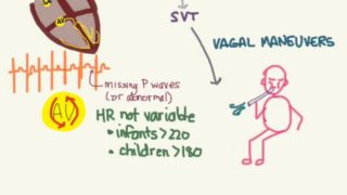 PALS 08: Tachycardias