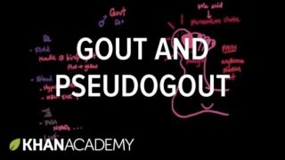 Pseudogout and Gout Pathophysiology