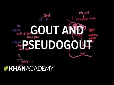 Pseudogout and Gout Pathophysiology