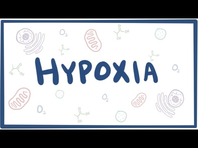 Causes, Symptoms, Diagnosis, Treatment ... Biology Diagrams