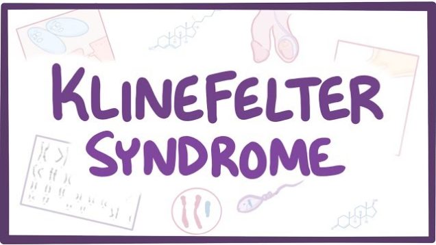 Klinefelter syndrome – causes, symptoms, diagnosis, treatment, pathology