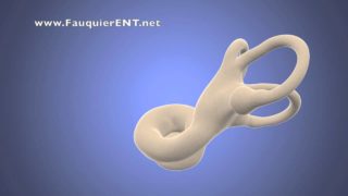 Meniere’s Disease – What Happens in the Inner Ear?