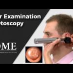 Otoscopy (Ear Examination) – ENT