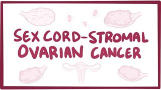 Sex cord-stromal ovarian cancer- causes, symptoms, diagnosis, treatment, pathology