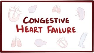 Congestive heart failure (CHF) – systolic, diastolic, left side, right side,  symptoms