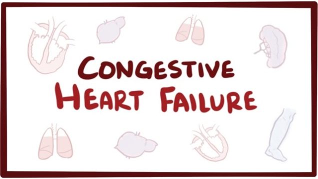 Congestive heart failure (CHF) – systolic, diastolic, left side, right side,  symptoms