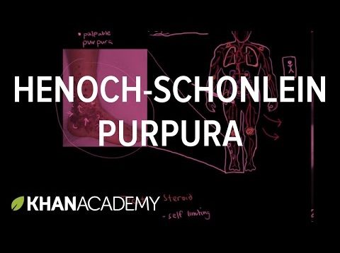 Henoch-Schonlein purpura | Circulatory System and Disease | NCLEX-RN | Khan Academy