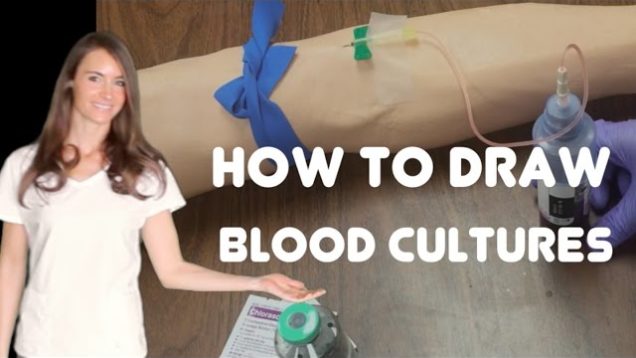 How to Collect Blood Cultures