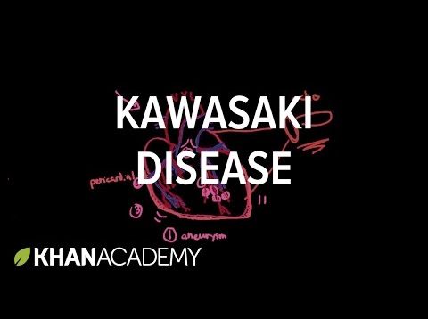 Kawasaki disease: diagnosis and treatment | Circulatory System and Disease | NCLEX-RN | Khan Academy
