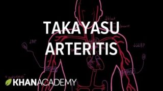 Takayasu arteritis | Circulatory System and Disease | NCLEX-RN | Khan Academy