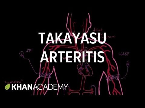 Takayasu arteritis | Circulatory System and Disease | NCLEX-RN | Khan Academy