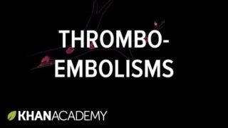 Thrombo-emboli and Thromboembolisms