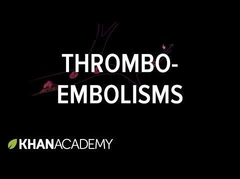 Thrombo-emboli and Thromboembolisms