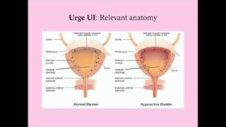 Urge Urinary Incontinence – CRASH! Medical Review Series