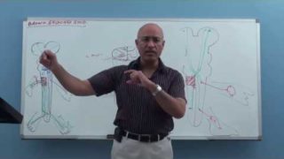 Brown Sequard Syndrome – Internal Medicine