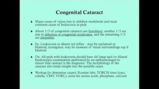 Cataract – CRASH! Medical Review Series