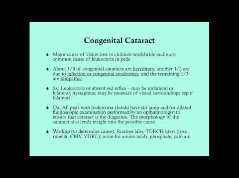 Cataract – CRASH! Medical Review Series